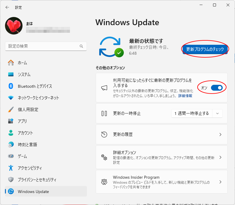 ［Windows Update］の［利用可能になったらすぐに最新の更新プログラムを入手する］と［更新プログラムのチェック］