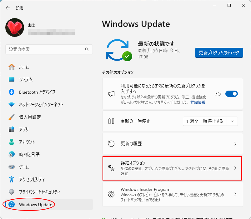 ［Windows Update］の［詳細オプション］