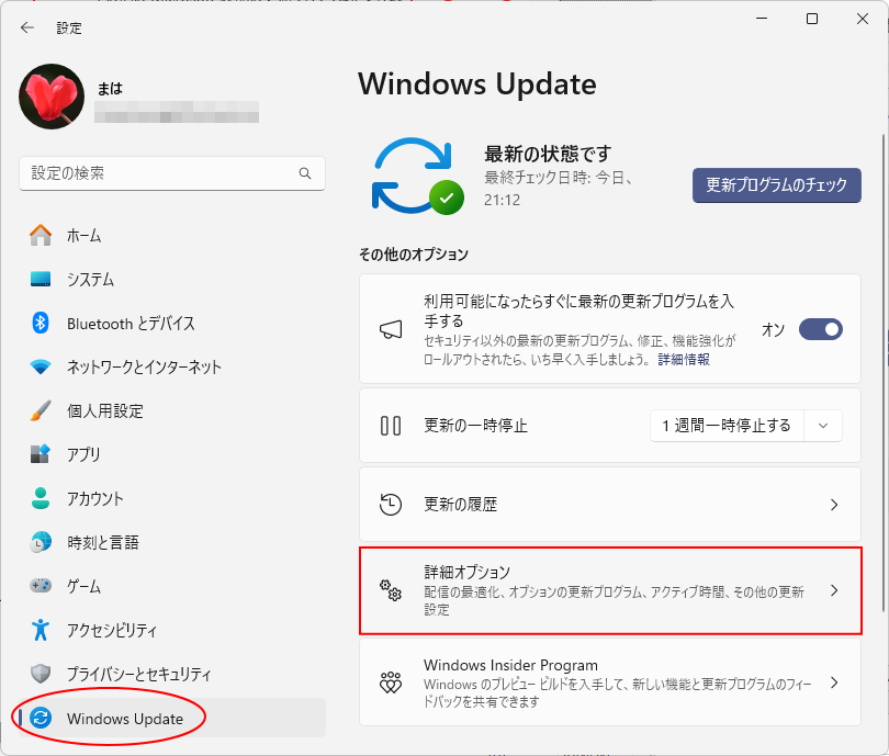 Windows Updateの［詳細オプション］